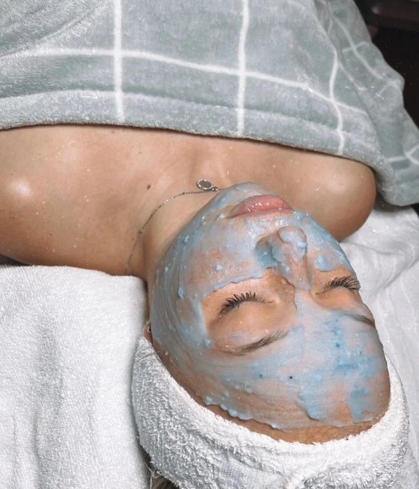 Peeling chimique
